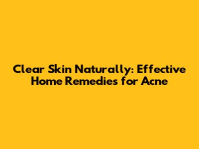 Clear Skin Naturally: Effective Home Remedies for Acne
