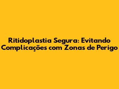 Ritidoplastia Segura: Evitando Complicações com Zonas de Perigo