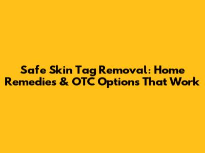 Safe Skin Tag Removal: Home Remedies & OTC Options That Work
